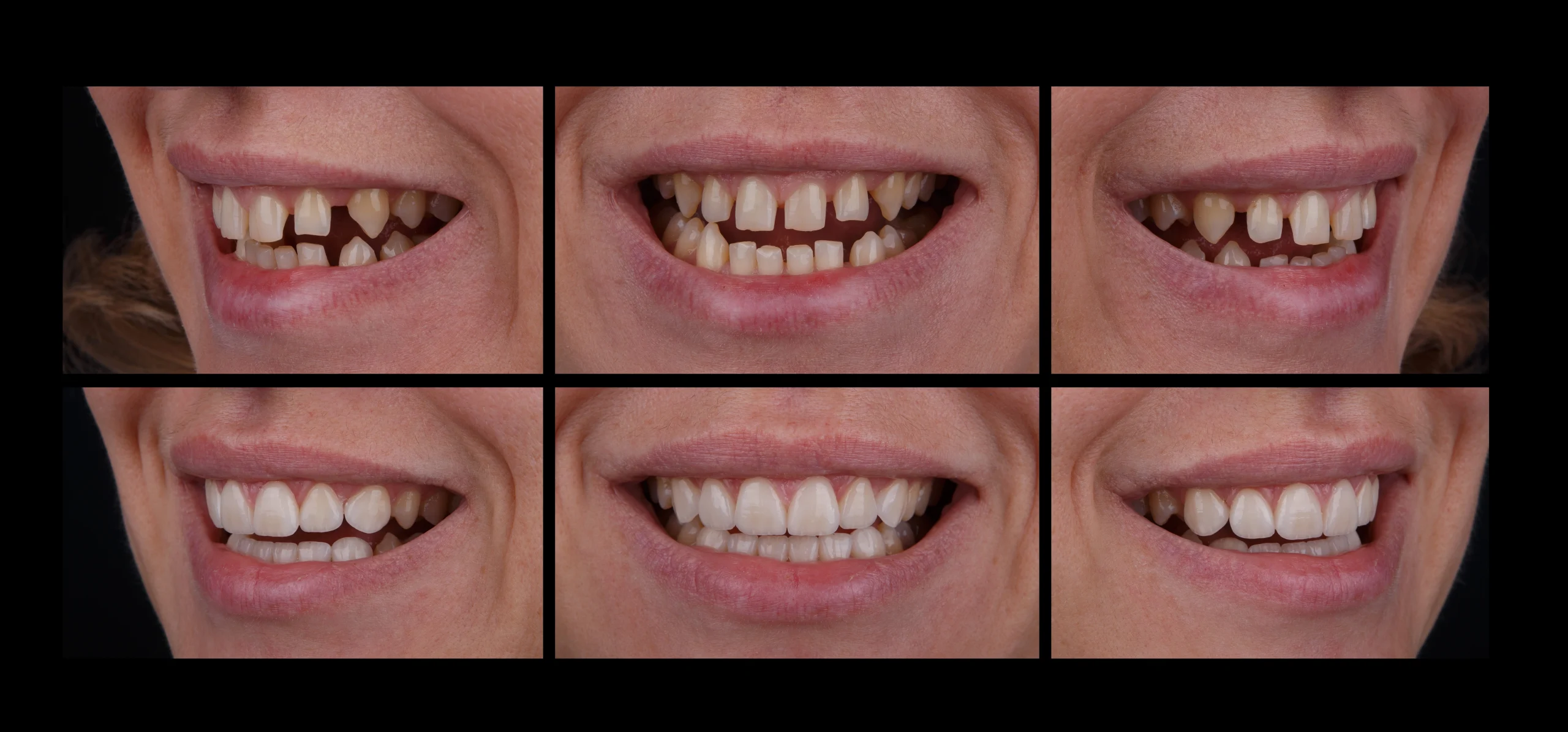 korektsia-yasen-ternopil-1