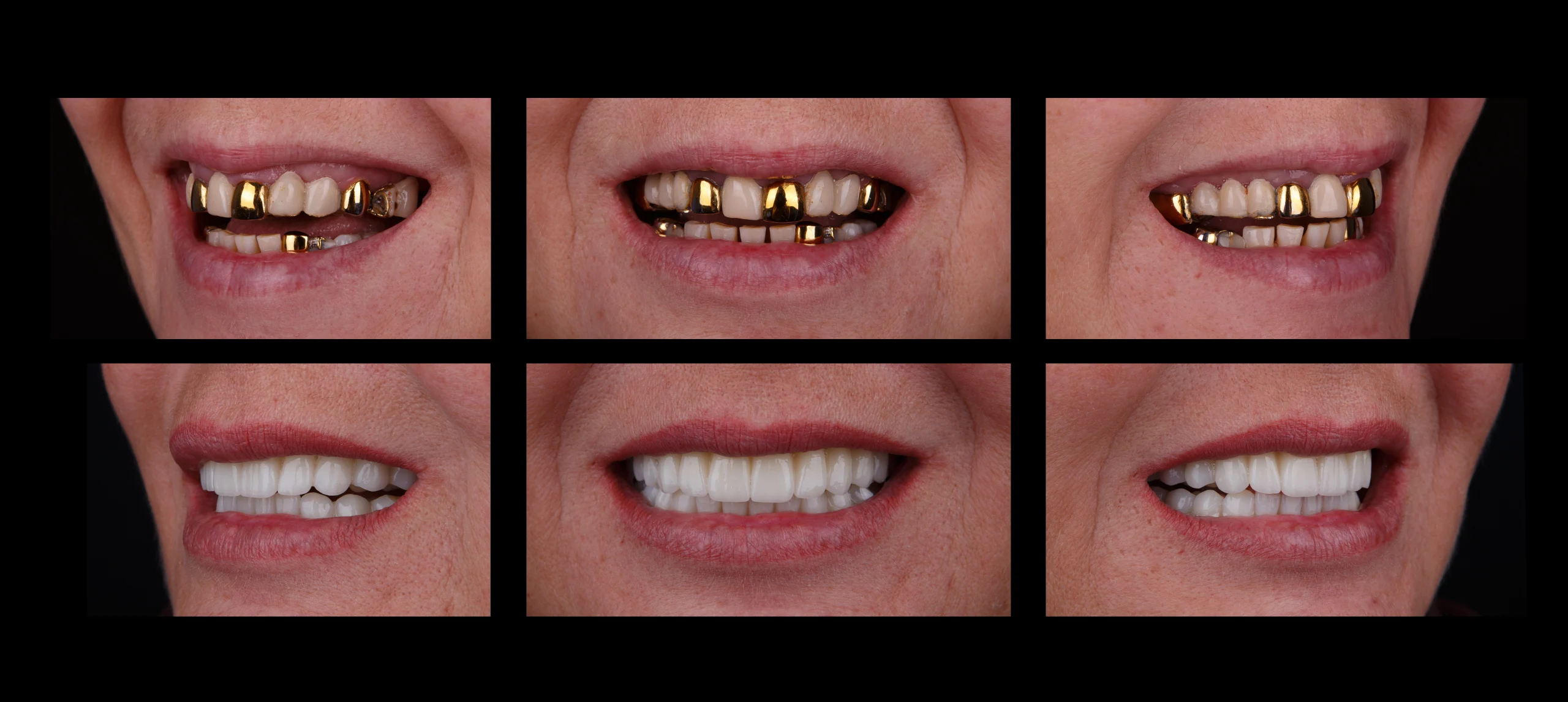 tsyrkinievi-koronky-ternopil-1